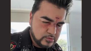 El Mimoso aparece golpeado en el rostro y nadie sabe por qu&eacute;