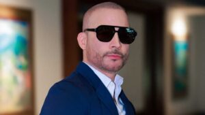 Germán Montero sorprende al confesar que no volvería a hacerse un trasplante capilar