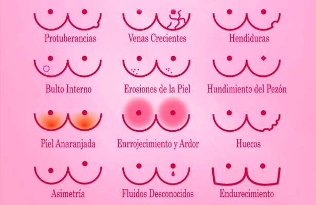blog_cambioseno