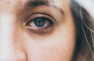 4 tips para eliminar las ojeras provocadas por el estrés de la pandemia