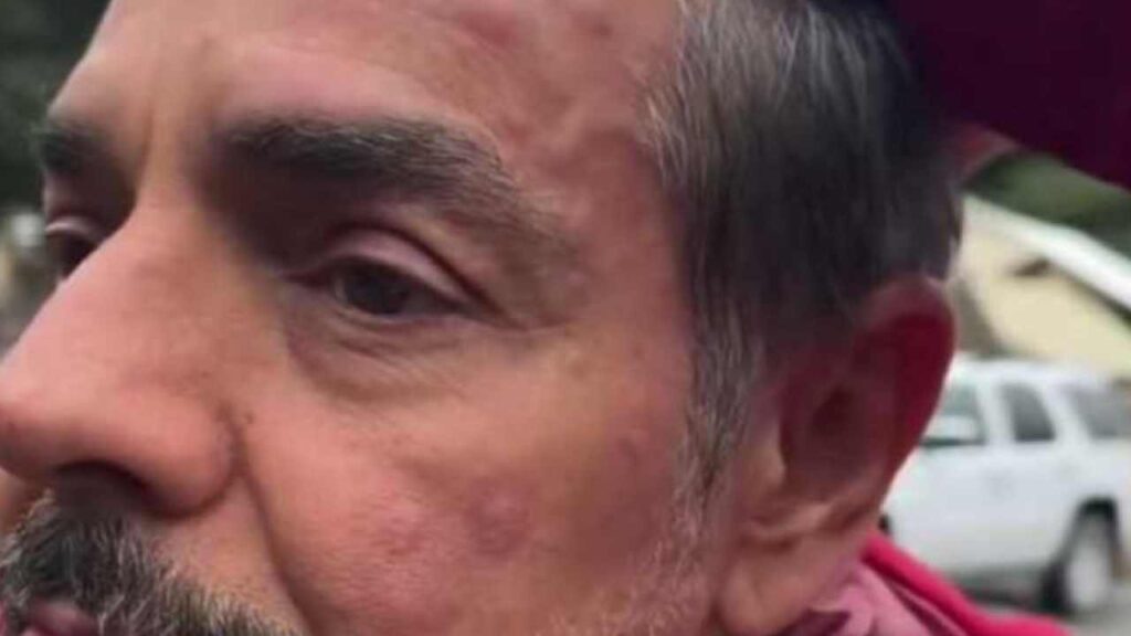 &iexcl;Eugenio Derbez preocupa a su fans tras aparecer con el rostro hinchado!