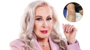 Laura Zapata preocupa a sus seguidores tras mostrar el doloroso proceso que enfrenta en España