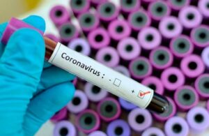 Disminuye n&uacute;mero de contagios por Covid_19 a nivel mundial