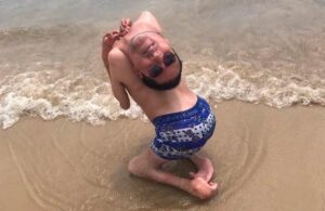 Claudio, el hombre que naci&oacute; con la cabeza al rev&eacute;s, dio positivo a Covid_19