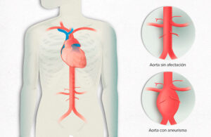 Estudio: Con mover un solo dedo podr&iacute;a saber si padeces una condici&oacute;n cardiovascular grave