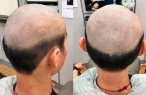 Con horrible corte de cabello, mam&aacute; evita que su hijo se contagie de Covid