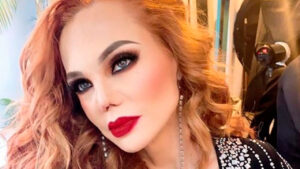 Carmen Campuzano sorprende con renovada imagen tras cirug&iacute;a reconstructiva de nariz