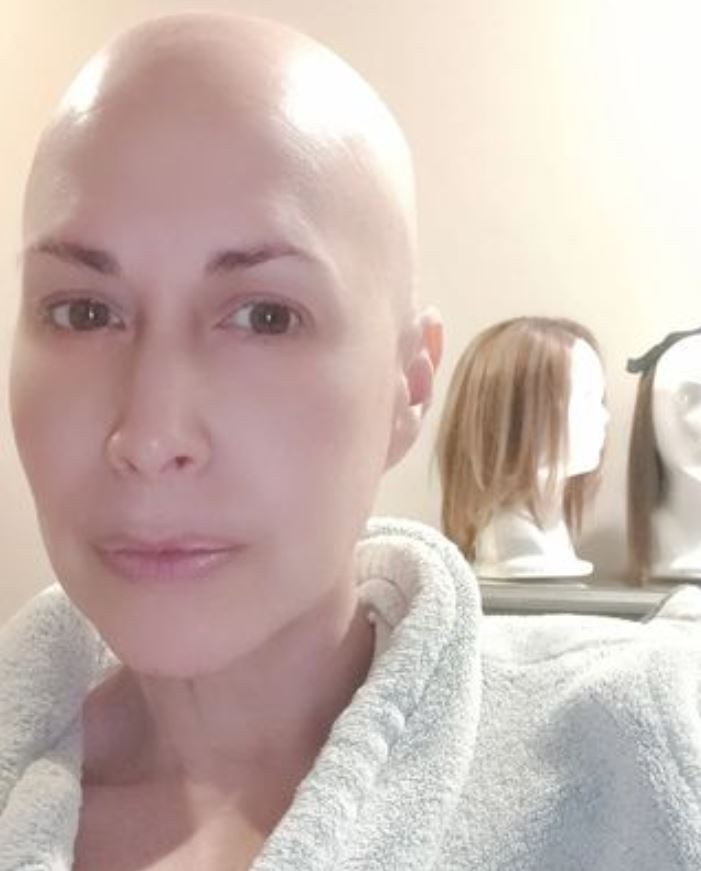 Marta Guzm&aacute;n se despoja de su peluca en programa en vivo