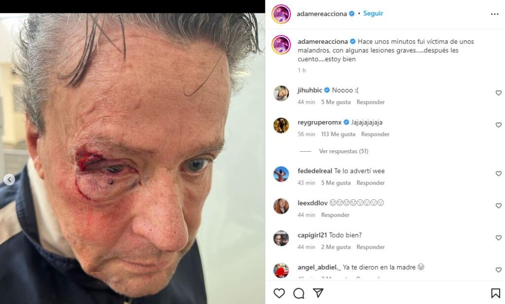 Alfredo Adame sufre brutal golpiza, podr&iacute;a tener desprendimiento de retina