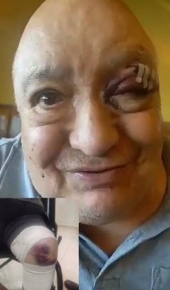 &iexcl;Luis de Alba sufre grave accidente que lo lleva al hospital! 