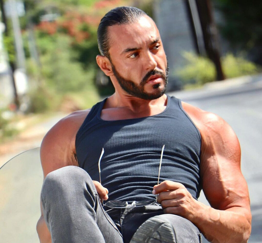 Latin Lover es sometido a delicada cirug&iacute;a: "tuve miedo"