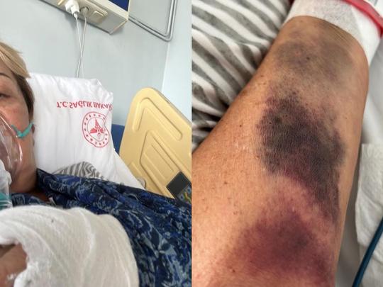 &iexcl;Sylvia Pasquel habr&iacute;a sido hospitalizada de emergencia debido a una trombosis!
