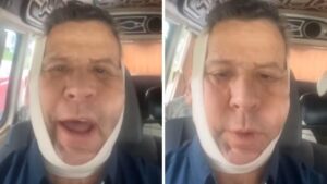 Alfredo Adame reaparece con moretones en el rostro, &iquest;se volvi&oacute; a pelear?