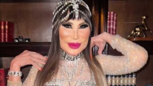 &iexcl;Lyn May busca un &ldquo;milagro&rdquo; en Los &Aacute;ngeles para mejorar su rostro!