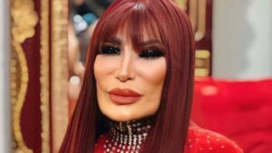 ¡Lyn May intentó quitarse la vida tras inyectarse aceite y ver su rostro desfigurado!